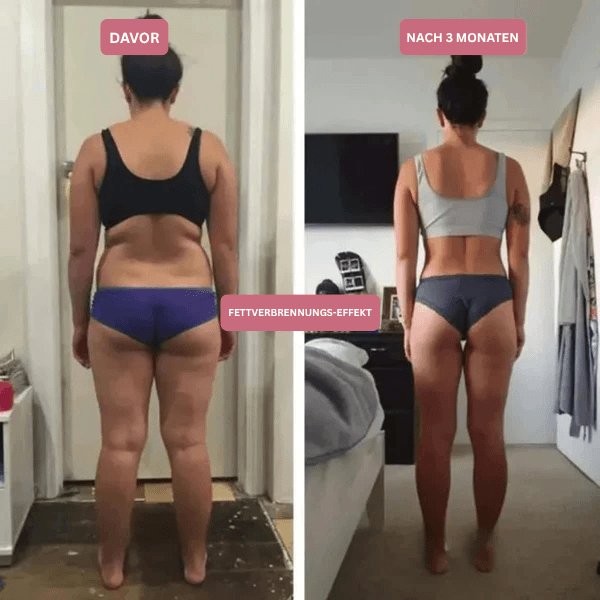 3D Anti-Cellulite-Kompressionsleggings